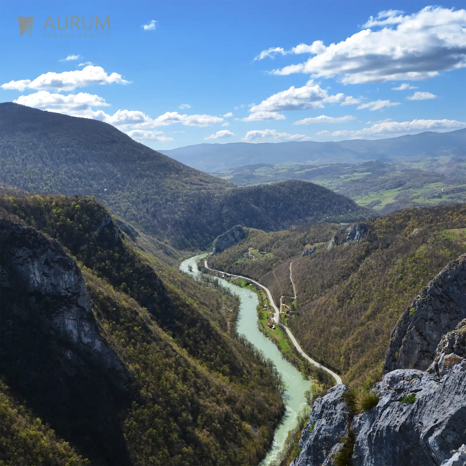Šta je to dentalni turizam?