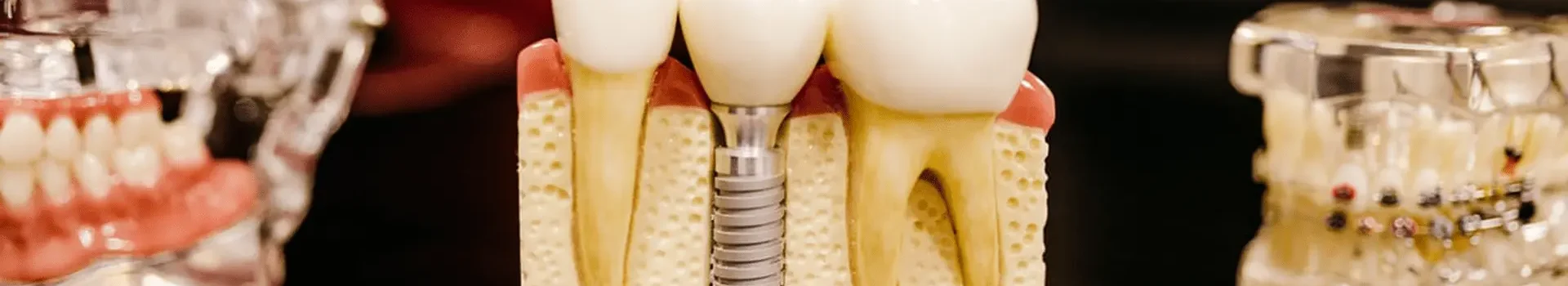 Endodoncija