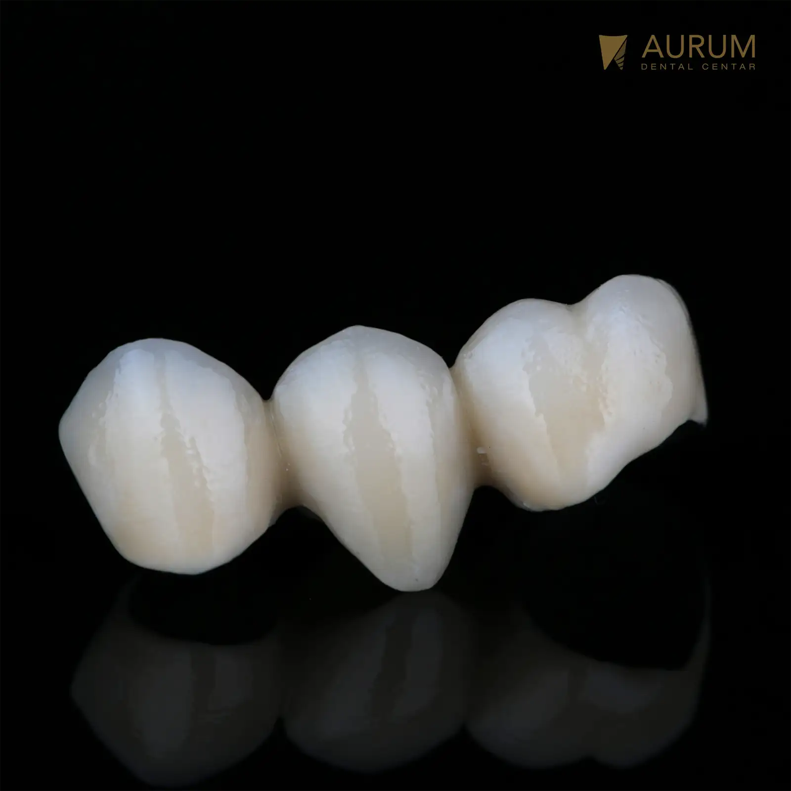 Cirkonske krunice: Savršen osmijeh u tri posjete