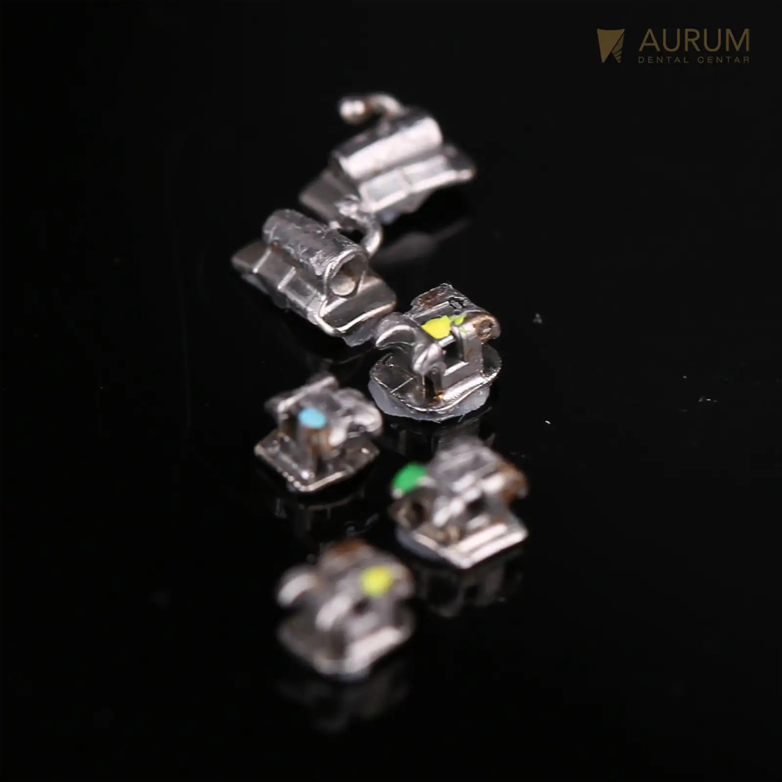 FIKSNA PROTEZA ZA ZUBE. Ortodoncija vilice.